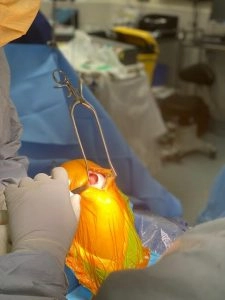 Osteochondral Allograft Knee Surgery Image of Open Knee