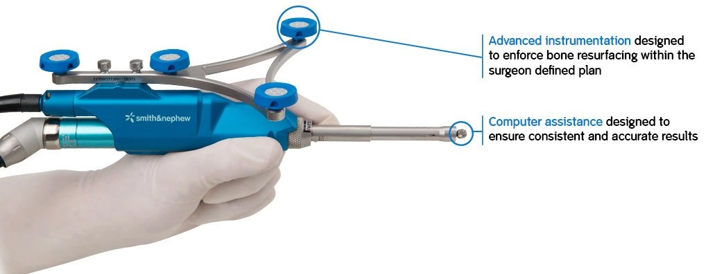 robotic-knee-replacement